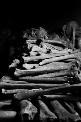 Bones